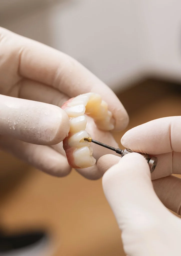 Implante dental de carga inmediata en 24h