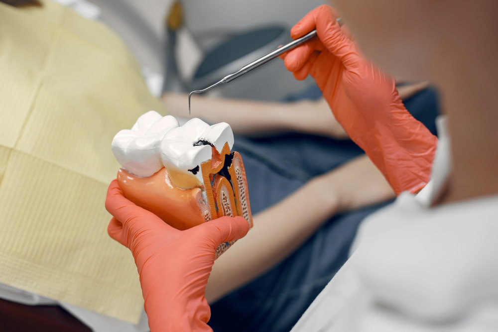 Endodoncia Málaga