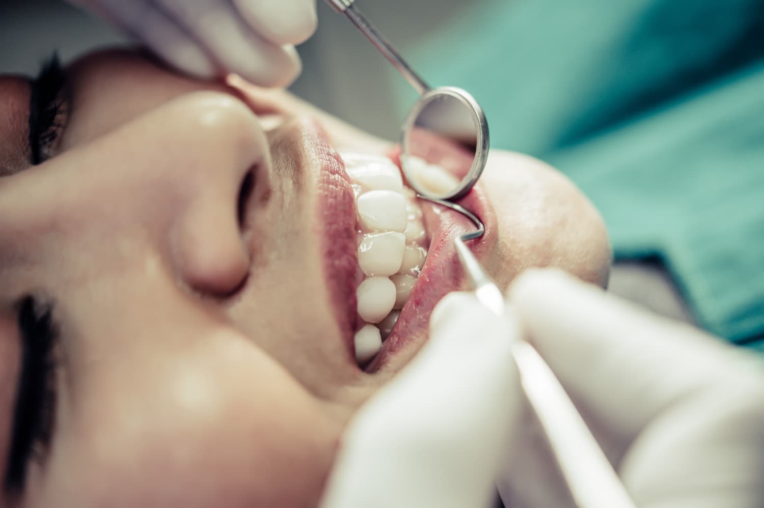 cirugía oral dental