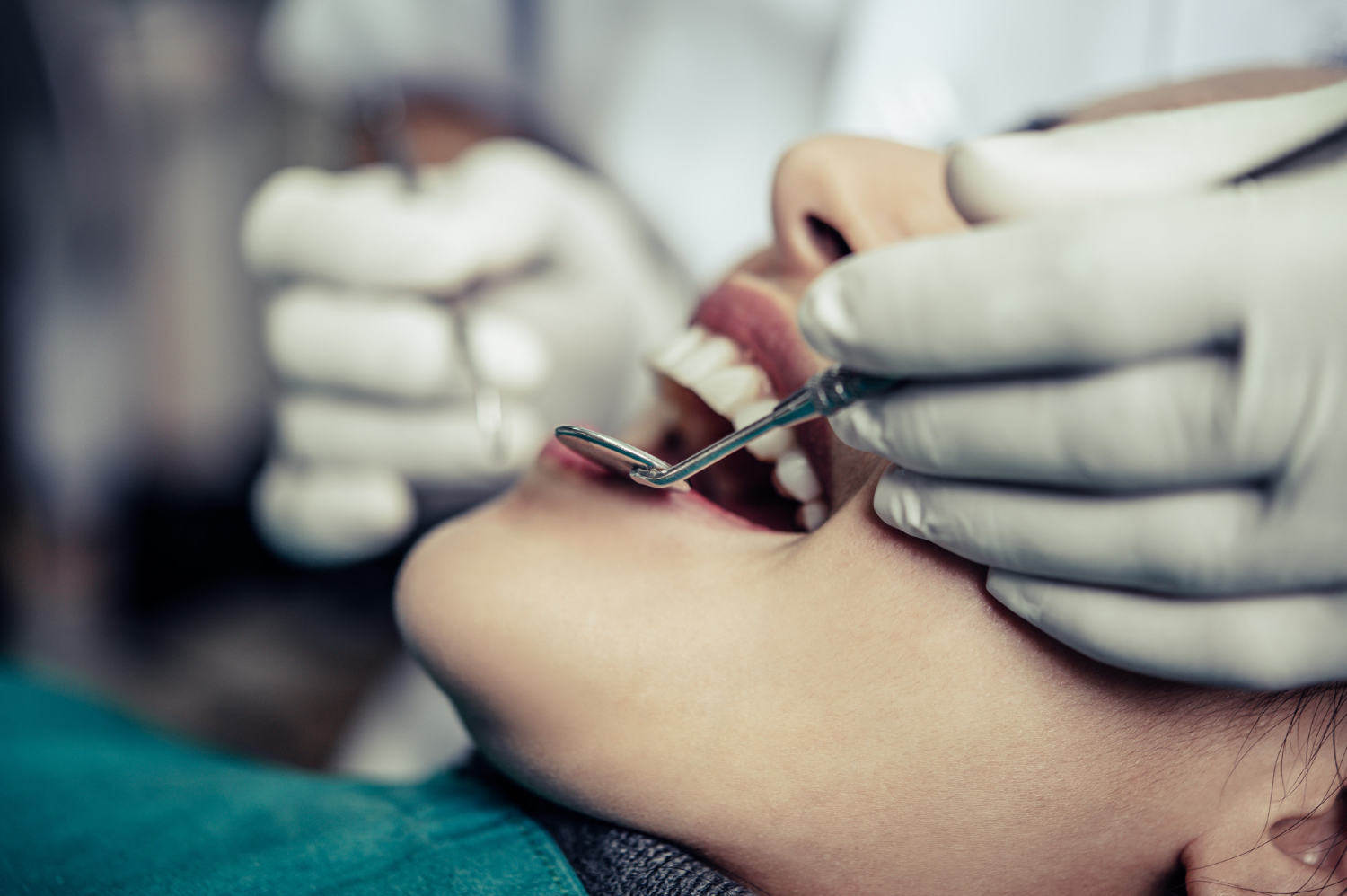 cirugía oral estetica