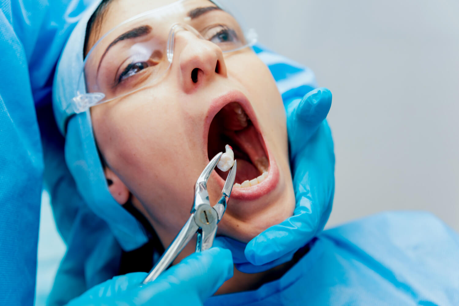 extracciones dentales son necesarias